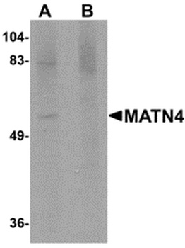 MATN4 Antibody