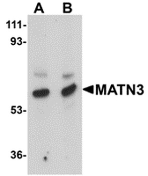 MATN3 Antibody