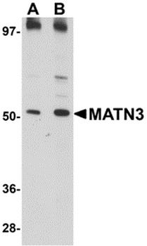 MATN3 Antibody