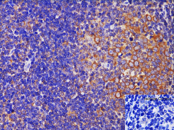 IL-21 Antibody