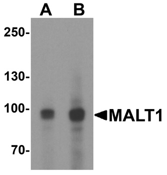 MALT1 Antibody
