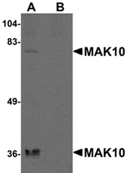 MAK10 Antibody