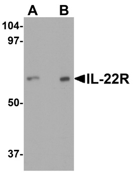 IL-22 Receptor Antibody