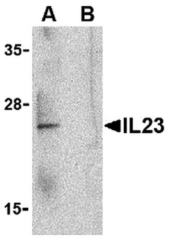 IL23A Antibody