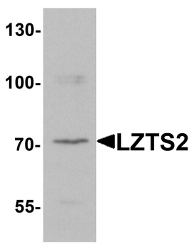 LZTS2 Antibody