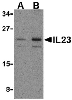 IL23A Antibody
