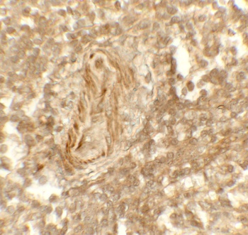KDM1A Antibody