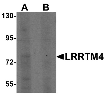 LRRTM4 Antibody