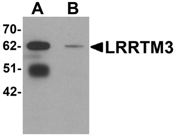 LRRTM3 Antibody
