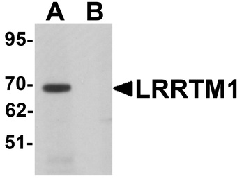 LRRTM1 Antibody