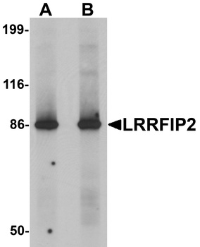 LRRFIP2 Antibody