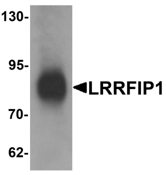 LRRFIP1 Antibody