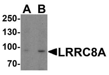 LRRC8A Antibody