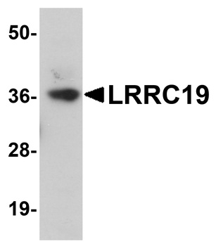 LRRC19 Antibody