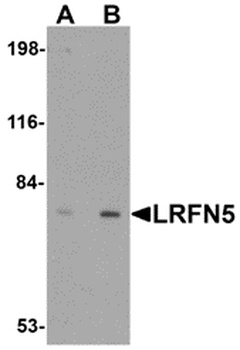 LRFN5 Antibody