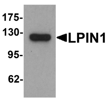 LPIN1 Antibody