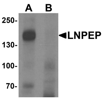 LNPEP Antibody