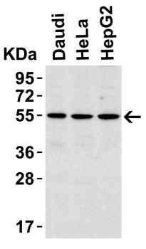 IRAK4 Antibody