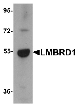 LMBRD1 Antibody