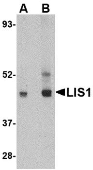 PAFAH1B1 Antibody