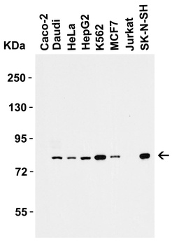 IRAK1 Antibody