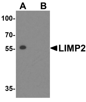 SCARB2 Antibody