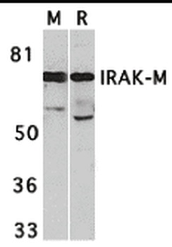 IRAK3 Antibody