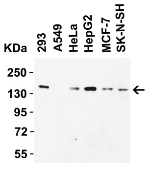 KDM3A Antibody