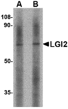 Lgi2 Antibody