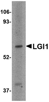 LGI1 Antibody