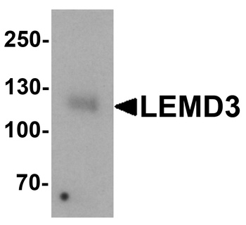 LEMD3 Antibody