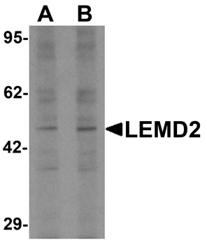 LEMD2 Antibody