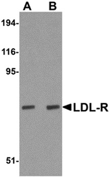 LDLR Antibody