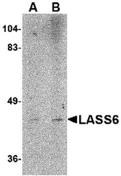 CERS6 Antibody