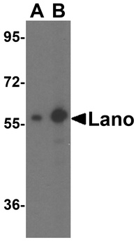 LRRC1 Antibody