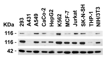 KL Antibody