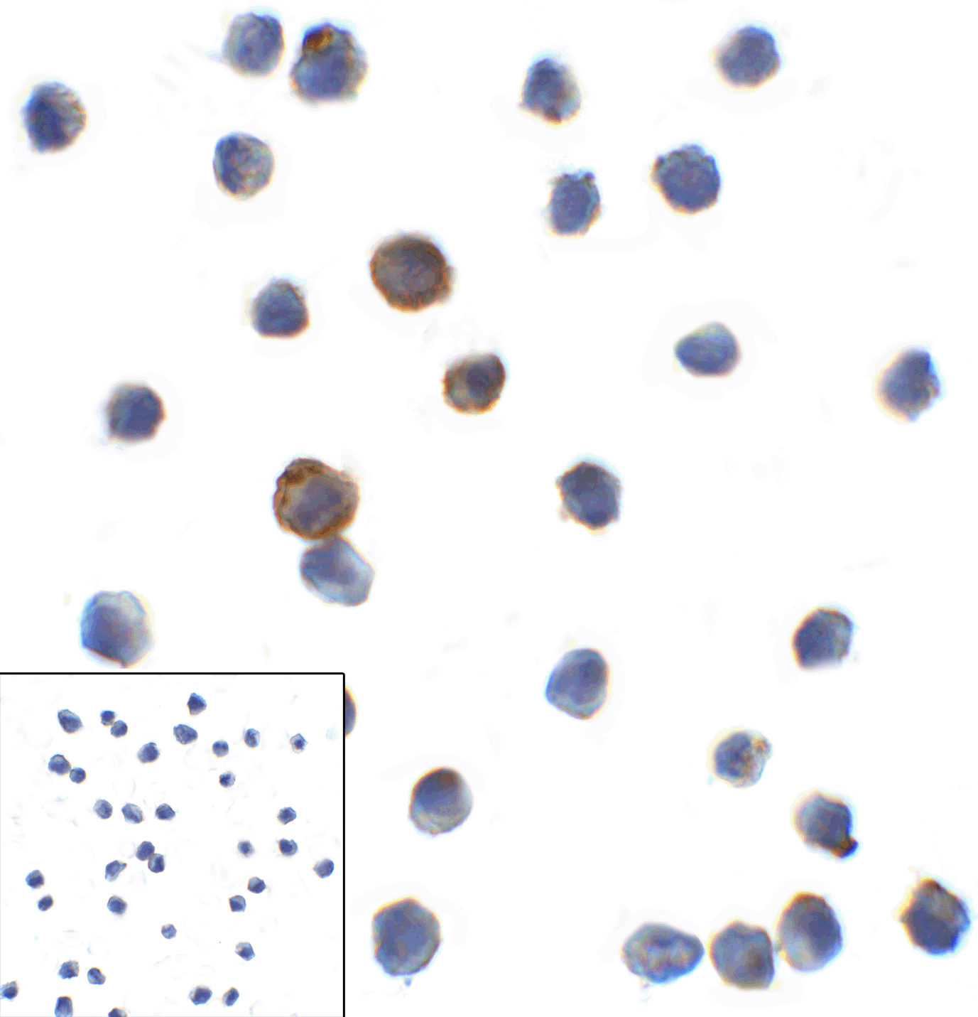 LAG3 Antibody [9F9]