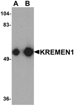 KREMEN1 Antibody
