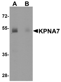 KPNA7 Antibody