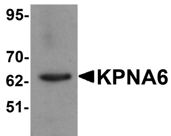 KPNA6 Antibody