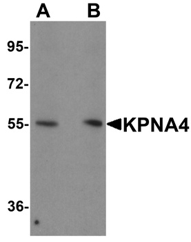 KPNA4 Antibody