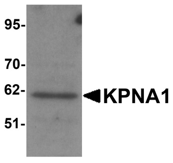 KPNA1 Antibody