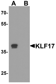 KLF17 Antibody