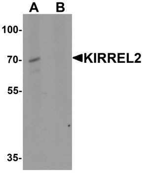 KIRREL2 Antibody