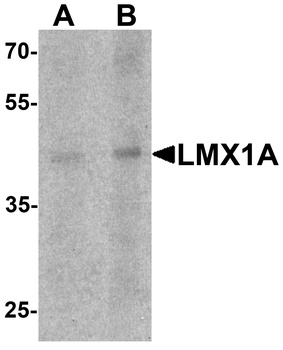 LMX1A Antibody