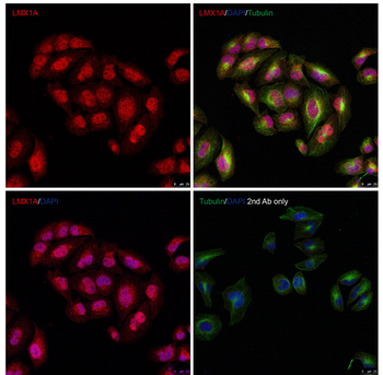 LMX1A Antibody