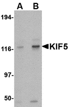 KIF5A Antibody