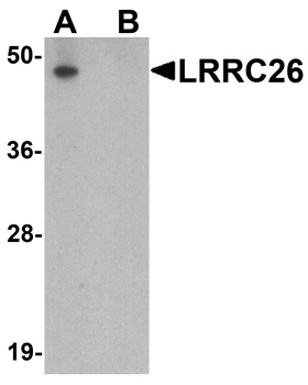 LRRC26 Antibody