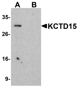 KCTD15 Antibody