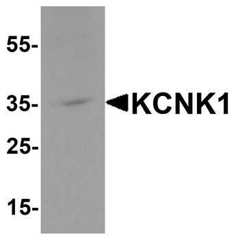 KCNK1 Antibody